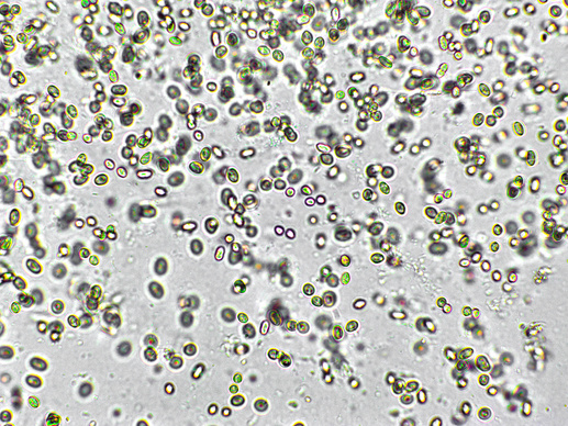 Chlorella vulgaris algae under microscopic view